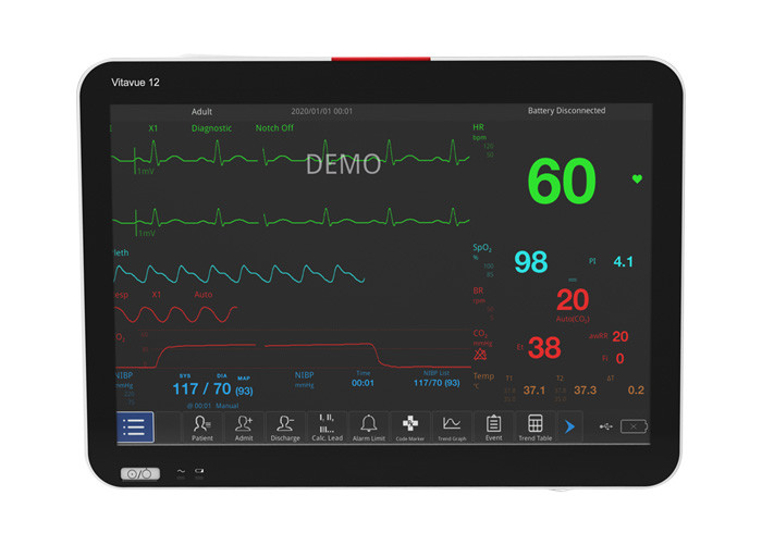 Cheap Touch Screen 40-240bpm Ecg Spo2 And Nibp Monitor 12.5mm/S To 50mm/S Print Speed for sale