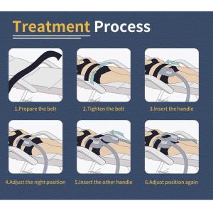 High Intense4 Handle Emslim Nova Machine Electromagnetic Ems Therapy Machine