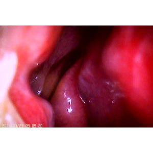 Wifi APP Digital Fundus Camera With Internal Capacity 16GB