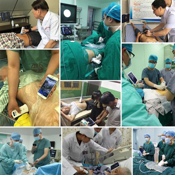 MSL Highest Cost-effective Double Probes Wireless Color Doppler Ultrasound Scanner