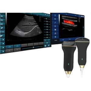 USB Ultrasonic Transducer Probe Handheld Ultrasound Scanner Wireless Only 150g