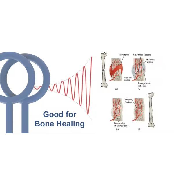 Professional Pemf Therapy Magneto Equines Pmst Loop Portable Magnetotherapy Pemf Therapy Machine For Horses