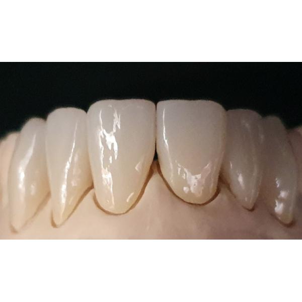 D98*22mm 3D Multilayer Zirconia 1050Mpa-700Mpa 43%-57% Translucency 6 Layers