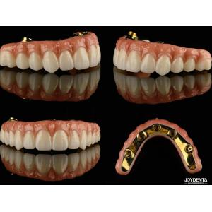 Ti Bar Zirconia Hybrid Implant Bridges High Translucency For Dental Prosthesis