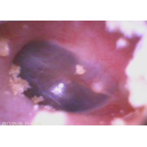 Optional Wifi Model Mini Otoscope Ophthalmoscope With Ultra - High Resolution