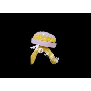 Translucencys IPS Emax Veneers , Minimal Preparation Emax Dental Veneers