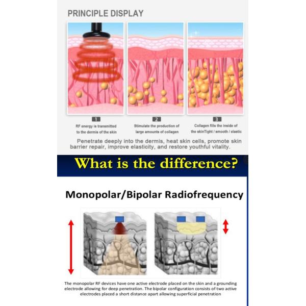 Facial Monopolar RF Radio Frequency Machine Skin Tightenng 0.3 - 0.5MHz