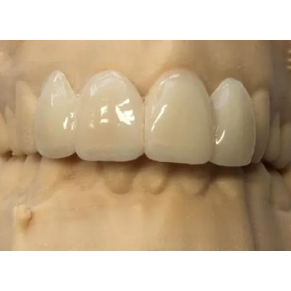 1050 Mpa Multilayer Zirconia Teeth Material CAD CAM For Dental Lab