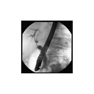 Non Vascular Sterile Hydro Slide Guidewire