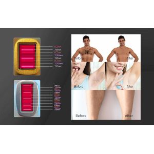 808nm 1064nm 755nm Diode Laser Hair Removal Machine with TEC Cooling System for