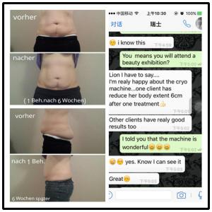 CE approval high quality effective result weight loss Cryolipoly machine