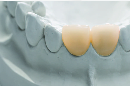 1200HV Zirconia Dental Block 3D Multilayer For Roland Lab Equipments