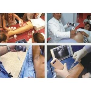 Pregnancy Wifi Color Doppler Ultrasound Scanner With Ob / Gyn Measurement