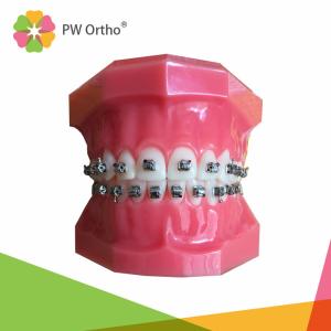 Easy Position Orthodontic Passive Self Ligating Brackets