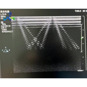 EPIQ 5 Ultrasound Machine Repair All Probe Images Are Abnormal Replace ACQ