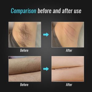 Top Stack Real 20 Million Diode Laser Hair Removal Machine With 3000W-5000W