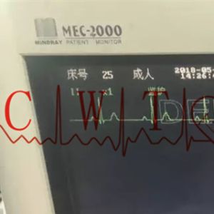 ECG Mindray Mec 2000 Used Patient Monitor For ICU / Adult