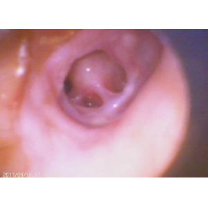 Handheld Video Camera Diagnostic Video Digital Otoscope Ophthalmoscope With USB