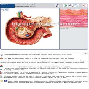 Stable Faster Metapathia GR Hunter 4025 analyzer monitor life resonance