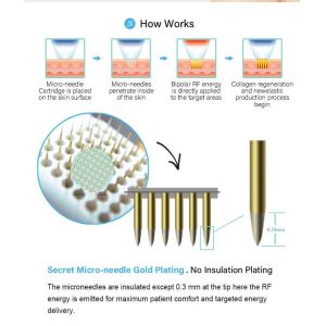 Cheap Skin Tightening Microneedle Fractional Rf Machine 10 Pins for sale