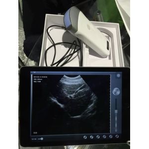 Pocket Ultrasonic Diagnostic Equipment Portable Ultrasound Scanner Supported