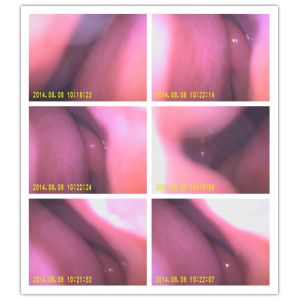 Handheld Video Camera Diagnostic Video Digital Otoscope Ophthalmoscope With USB