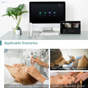 Customizable Scalp Analysis Machine For Dryness And Dandruff Problem