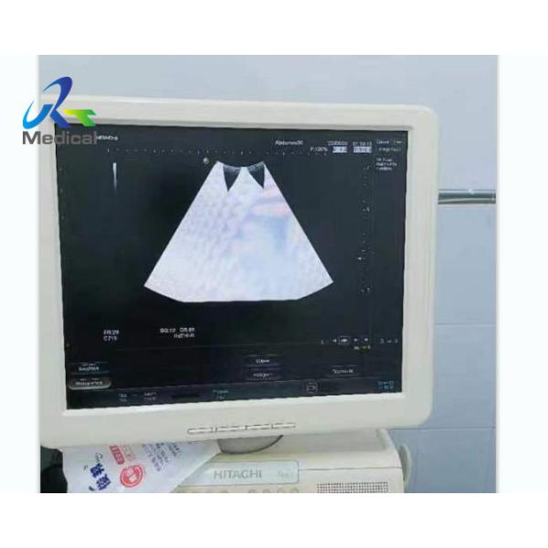 Doppler Ultrasound Machine Repair RXBF HI VISION Avius Image Bright Channel
