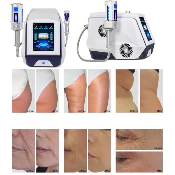 360 Rotating 9d Slim Inner Ball Roller Machine Body Contouring Cellulite Reduction Therapy