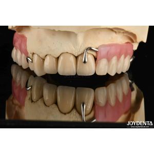 Elaborate Framework Final Set Stable Dental Structure Designed Teeth Finish