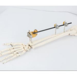 T Shaped Clamp External Fixator For Distal Radius Fracture OEM