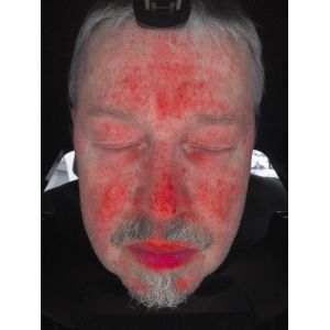 Cheap Facial Skin Scanner Analysis , Skin Analyzer Machine With Ce Certificate for sale