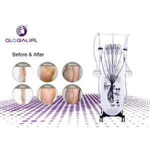 5 In 1 Ultrasound Therapy Cryolipolysis Machine Automatic Temperature Control