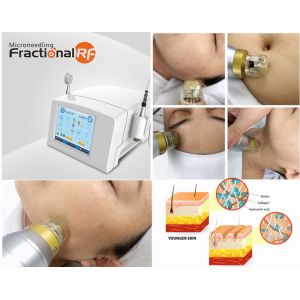 Portable Fractional Rf Microneedle Machine For Neck Wrinkle Reduction