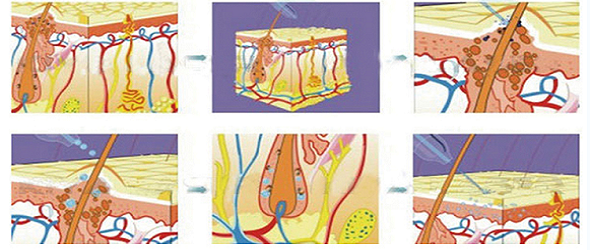 Face Hydro Diamond Peel Microdermabrasion Machine
