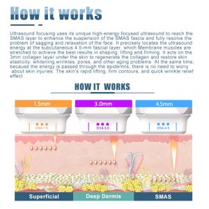 8.4 Inch LCD Color Touch Screen Focused Ultrasound Ablation Therapy Treatment