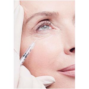Anti Aging Injectable Dermal Fillers For Filling Eyes Circle Tear Troughs