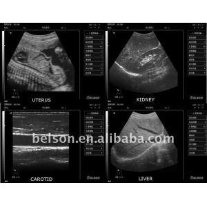 Andriod Color Doppler Ultrasound Scanner , Hand Held Doppler Machine Only 550g