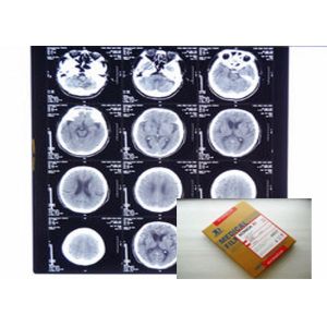 PET Medical Digital X Ray Film Stable With Agfa / Fuji Thermal Printers