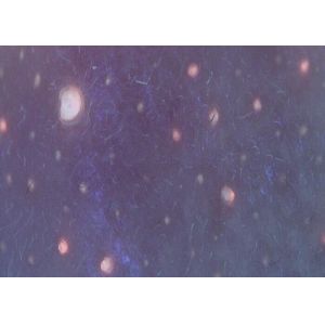 Digital Portable Skin Moisture Analyzer With APP Downloaded To Mobilephone