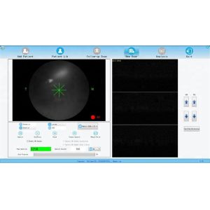 Professional Optical machine/ OCT with fundus camera function Optical Coherence