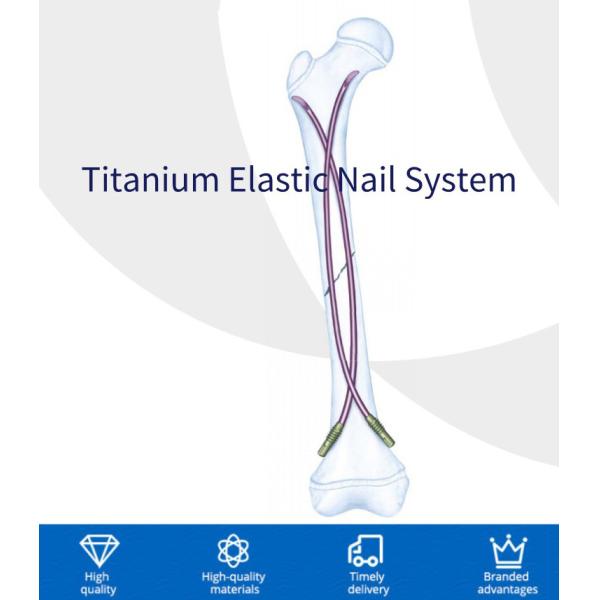 Precice Ti Alloy Surgery Interlocking Nail Femur Mechanical Stable