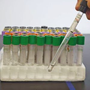 ESR & Erythrocyte Sedimentation Rate & Anticoagulation & Standardized Testing