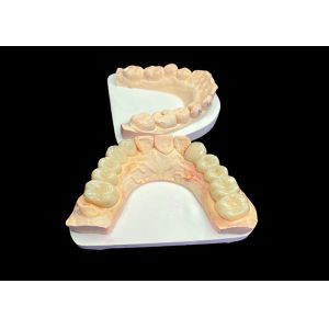 China Natural Aesthetics Translucent Ceramic Crowns for Dental Restoration with Easy Cleaning and Long-Lasting Results on sale