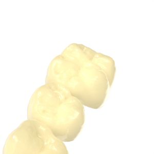 Durable Biocompatible 3d Resin Alike Temporary Crown Bridge Resin