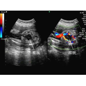 High-Tech Portable Color Doppler Ultrasound System Digital With 3D / 4D Software