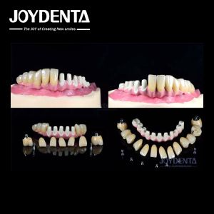 China Multiple Endosseous Dental Implants Internal Connection For Full Arch Restoration on sale