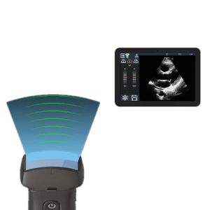 2 -11MHz Hand Held Color Doppler Ultrasound Scanner Like A Mobile Phone