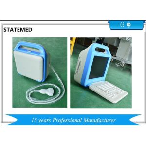 Ultrasound Imaging Machine , B Ultrasound Scanner Scanning Depth 240mm
