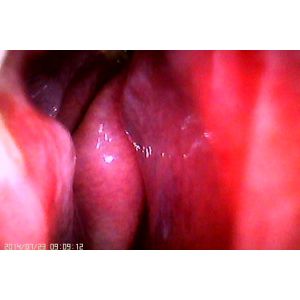 Wifi APP Digital Fundus Camera With Internal Capacity 16GB